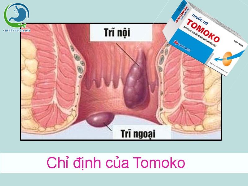 Chỉ định của thuốc trĩ Tomoko