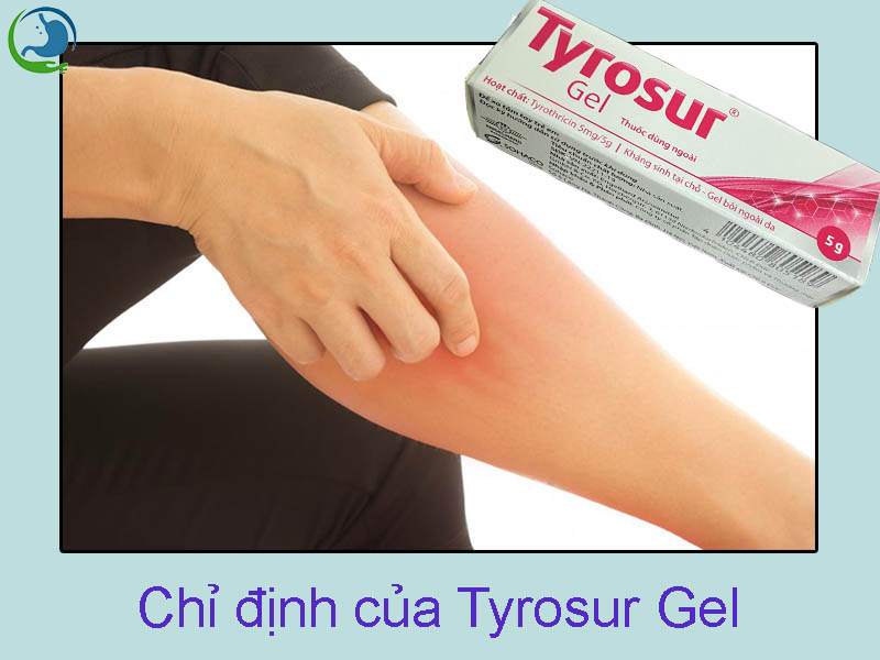 Chỉ định của thuốc Tyrosur Gel