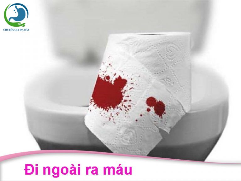 Đi ngoài ra máu