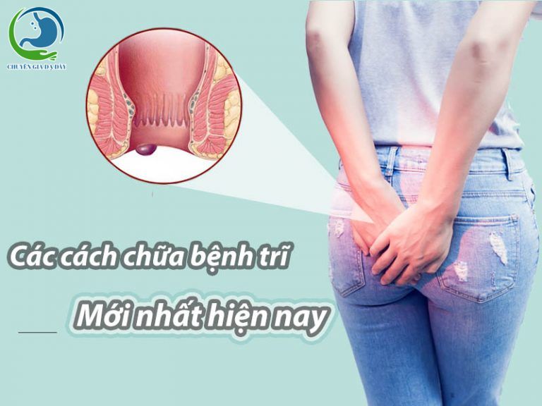 Các cách chữa bệnh trĩ mới nhất hiện nay