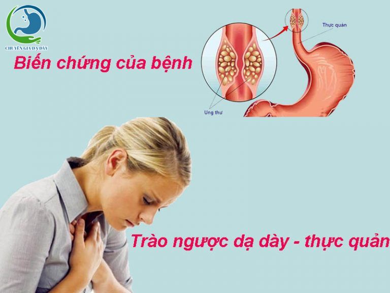 Biến chứng của bệnh trào ngược dạ dày - thực quản