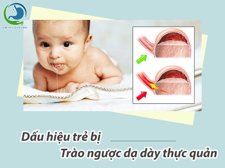 Dấu hiệu trẻ bị trào ngược dạ dày thực quản
