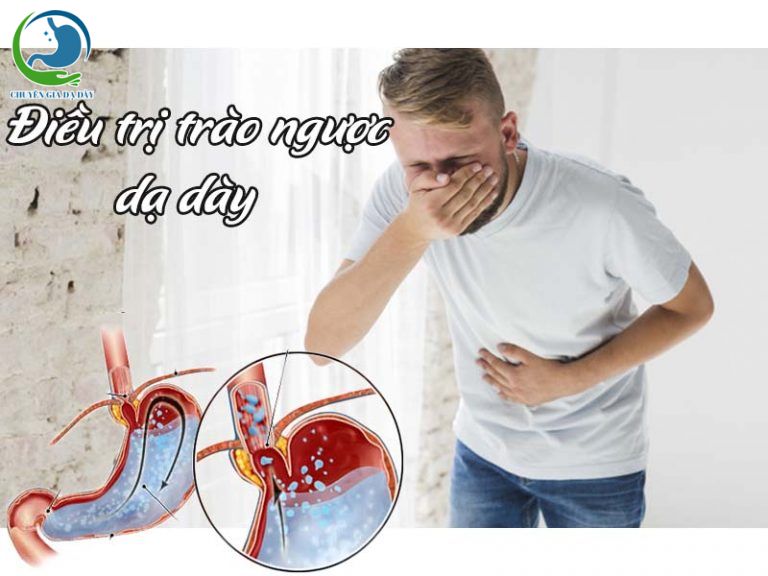 Điều trị trào ngược dạ dày thực quản