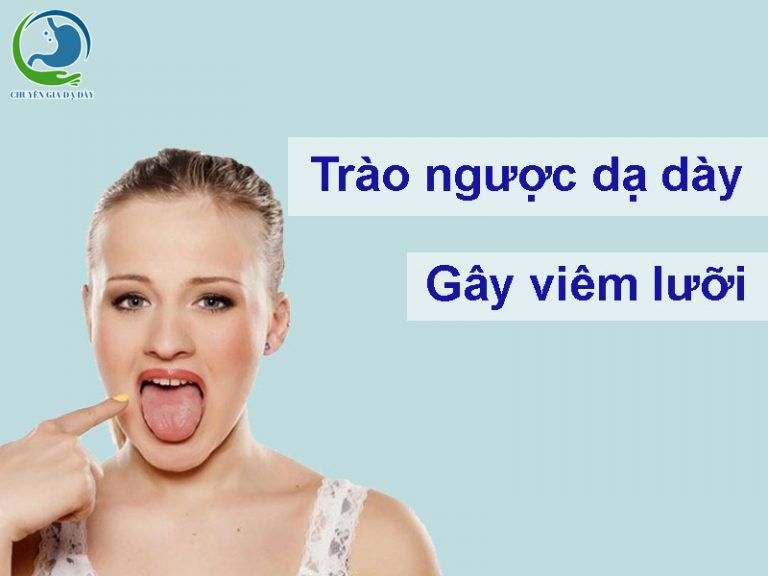 Trào ngược dạ dày gây viêm lưỡi