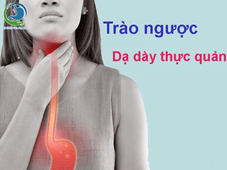 Bệnh trào ngược dạ dày thực quản