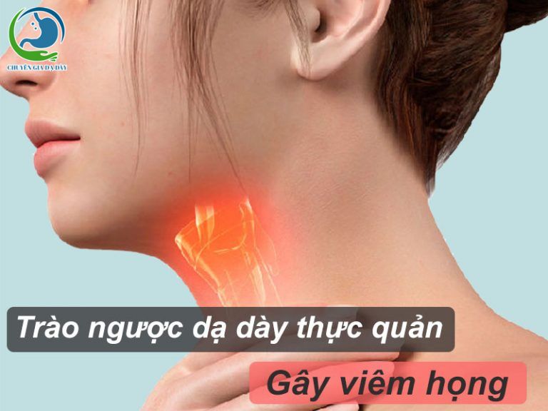 Nguyên nhân trào ngược dạ dày thực quản gây viêm họng và cách điều trị