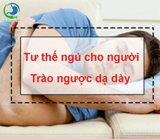 Tư thế ngủ cho người bị trào ngược dạ dày