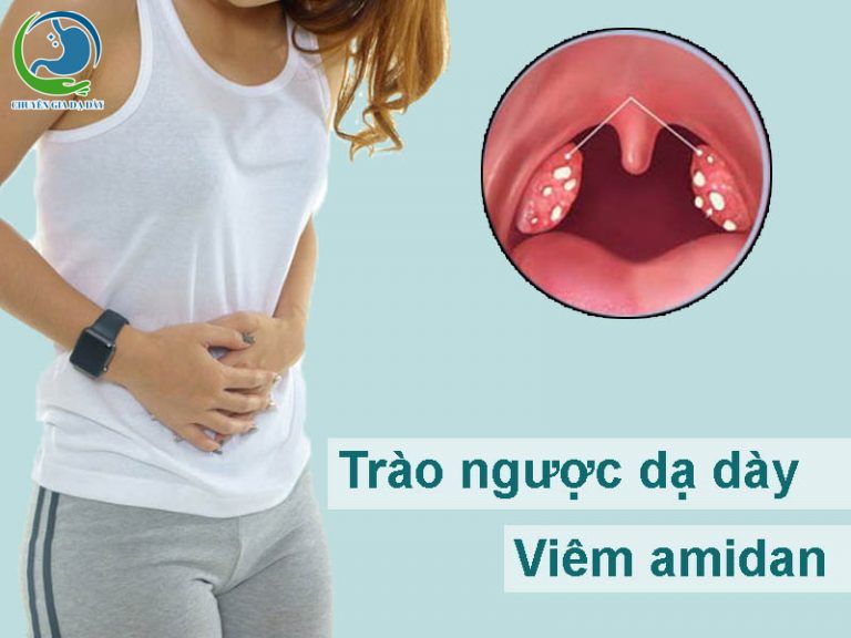 Trào ngược dạ dày viêm amidan