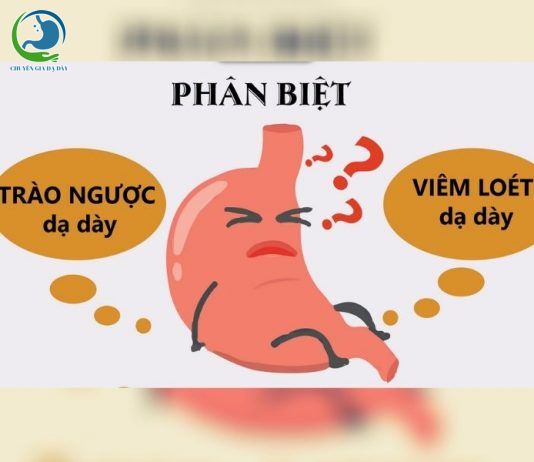 Phân biệt đau dạ dày và trào ngược dạ dày