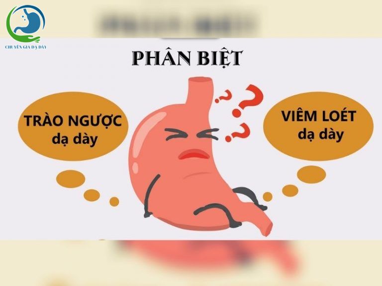 Phân biệt đau dạ dày và trào ngược dạ dày